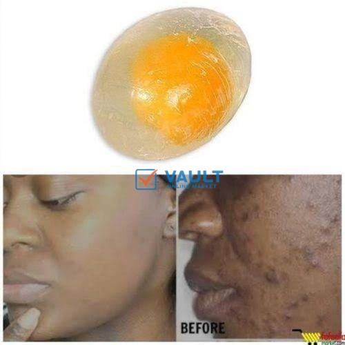 Egg Soap Egg Yolk Collagen Facial Soap For Sun Burn, Acne, Dark Spots